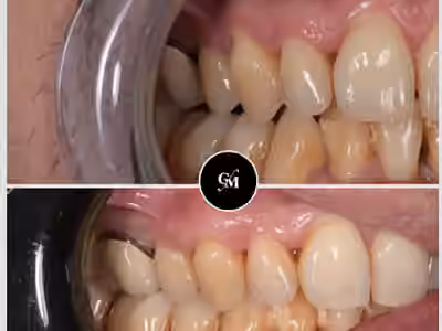 Cabinet Dentaire du Dr Gary MURCIANO – Dentiste Le Chesnay 78