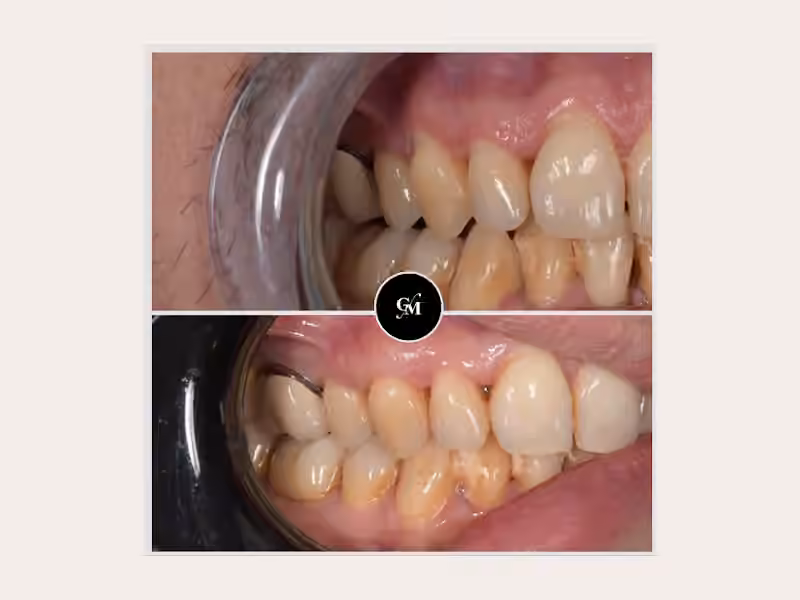 Cabinet Dentaire du Dr Gary MURCIANO – Dentiste Le Chesnay 78