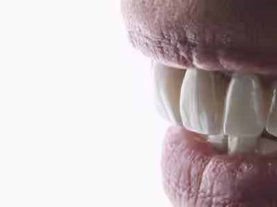 Dr Bourdin Clément - Chirurgien Dentiste