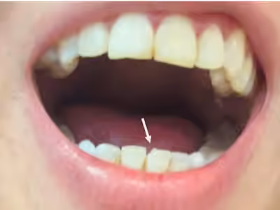 Dentiste Boulogne Dr. Marie-Paule Slama